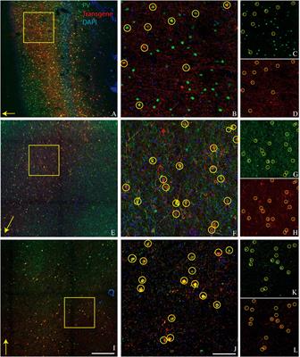 Preferential transduction of parvalbumin-expressing cortical neurons by AAV-mDLX5/6 vectors